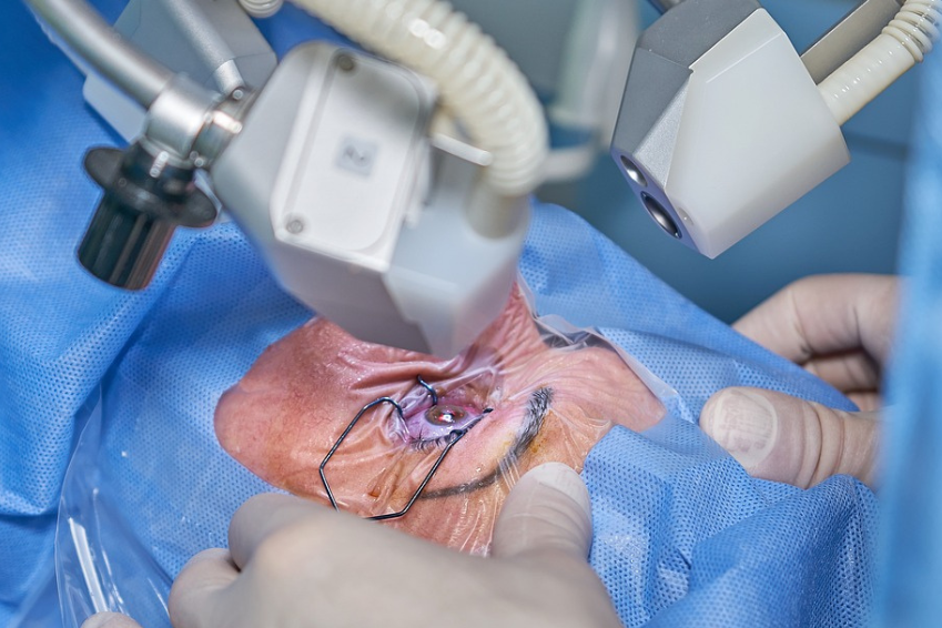 Glaukom Operation: Es können drei Operations- beziehungsweise Laserbehandlungstypen unterschieden werden