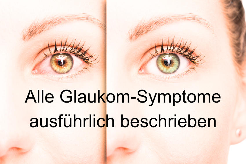 Die häufigsten Glaukom Symptome im Überblick