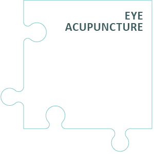 Integrated Eye Therapy according to Noll - Eye Acupuncture